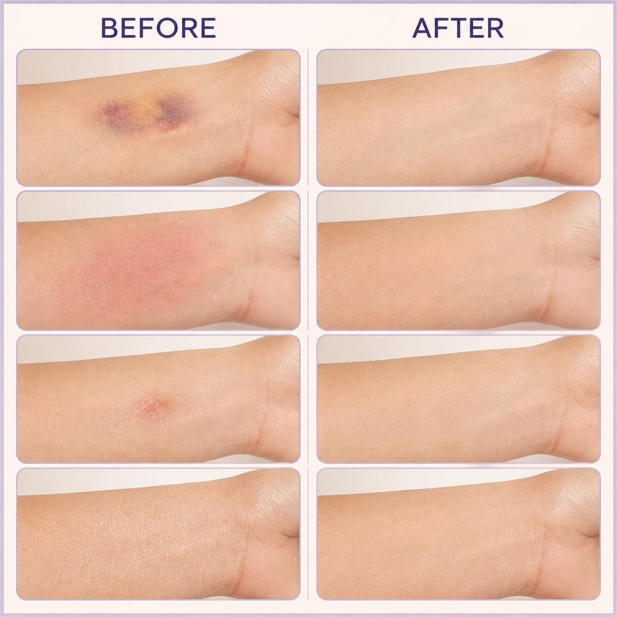 REUNOA Bruise Defense & Repair Serum